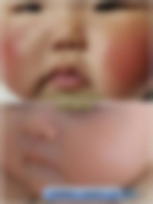 擅长项目详解