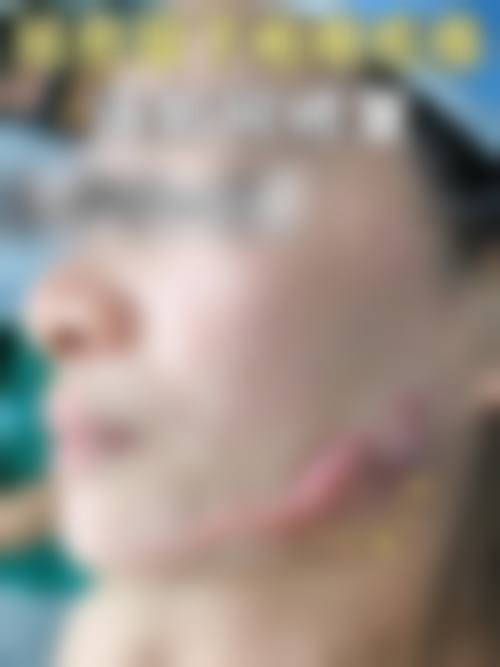 特色科室与项目：烧伤整形技术领跑