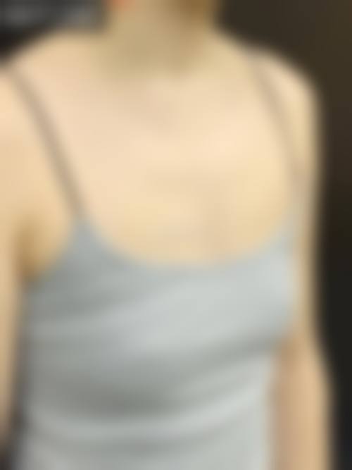 特色医美项目:精细定制,成效自然