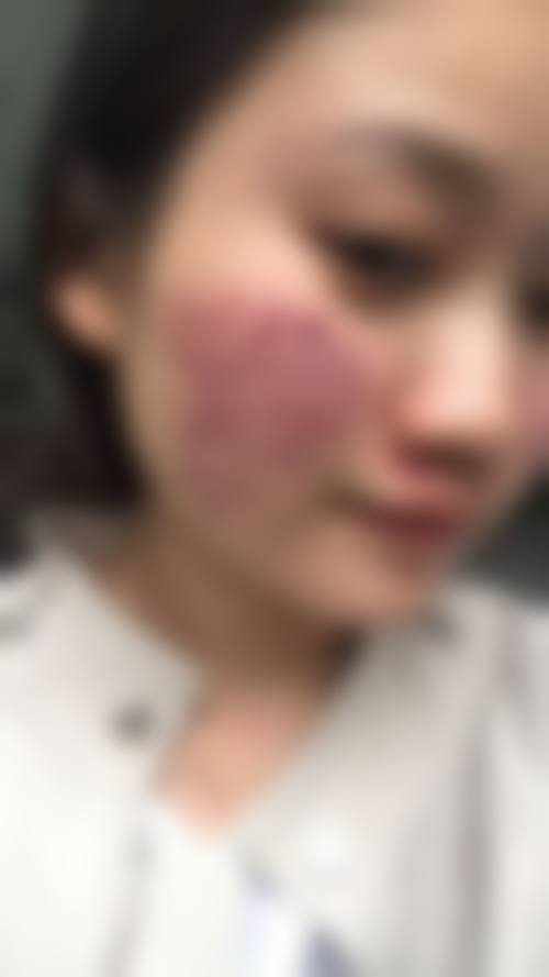 擅长项目详解
