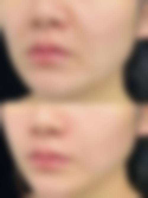 临床实例分享
