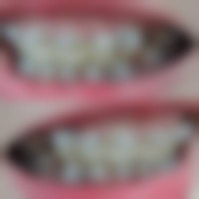 常见问题(FAQ)