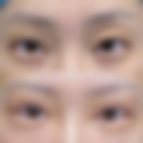 总结与预约号召