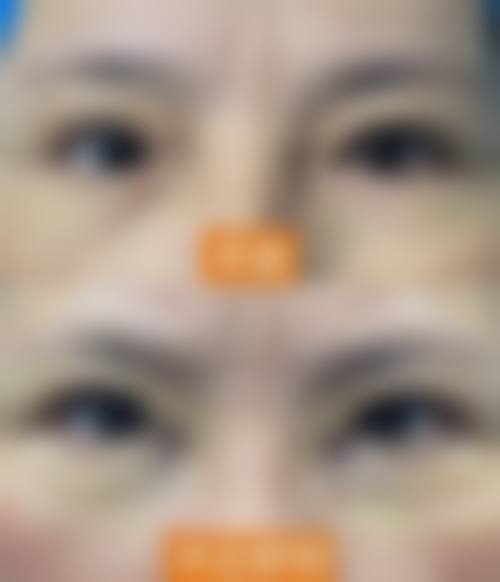 临床实例分享