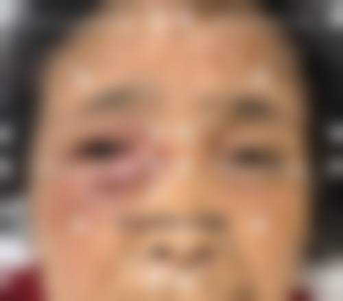 预约优惠活动