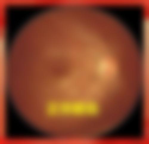 临床实例分享