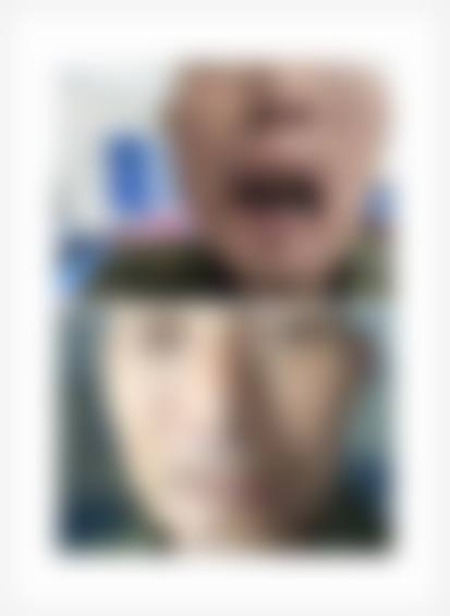 临床实例分享