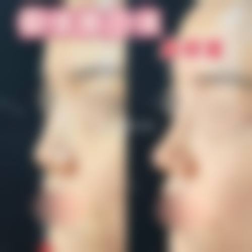 优惠活动详情:面部精细化雕刻限时直降6000元