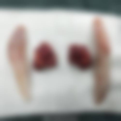 预约优惠活动