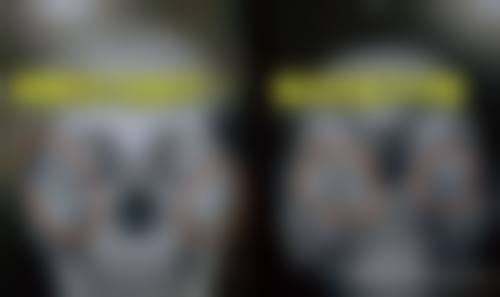 服务流程与保护：从预约到术后全程贴心