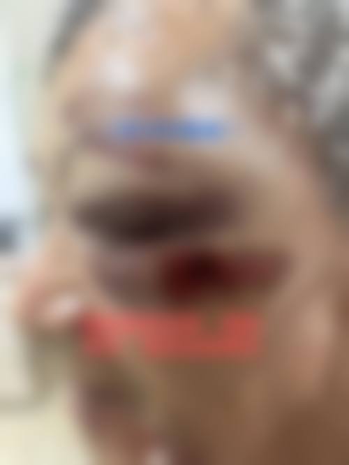 FAQ：黄冠南医生预约与诊疗常见问题