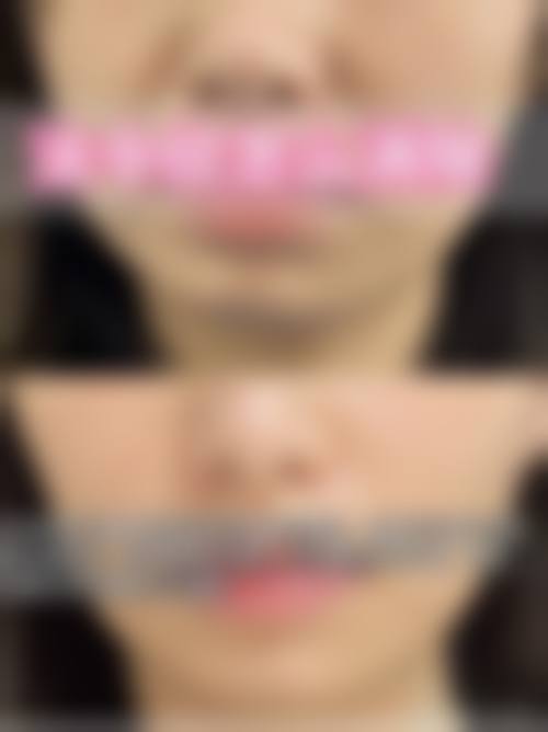 设备环境介绍：国内外标准硬件支撑手术安心