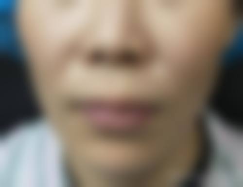 结尾：选择专精医美，从预约开始