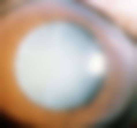 FAQ:医疗保险与优惠常见问题解答