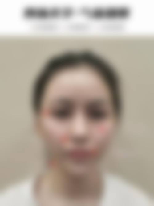 总结与预约号召