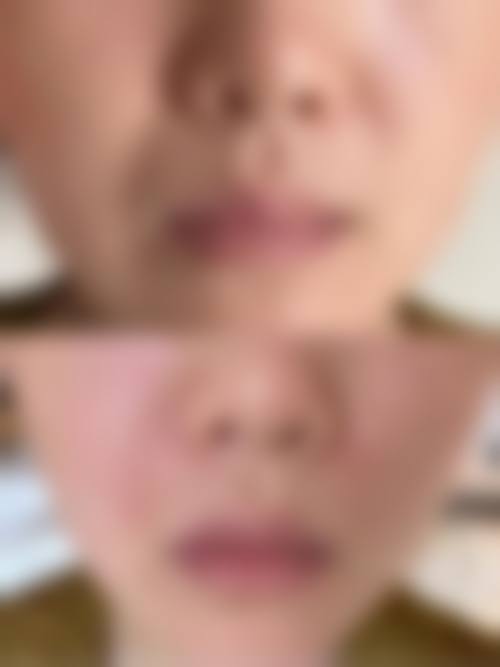 FAQ:常见问题解答