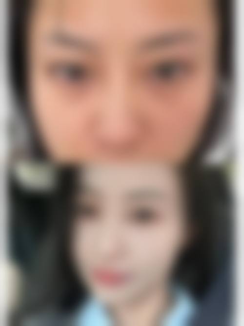 结语:选择正规医院,变得更美更安心