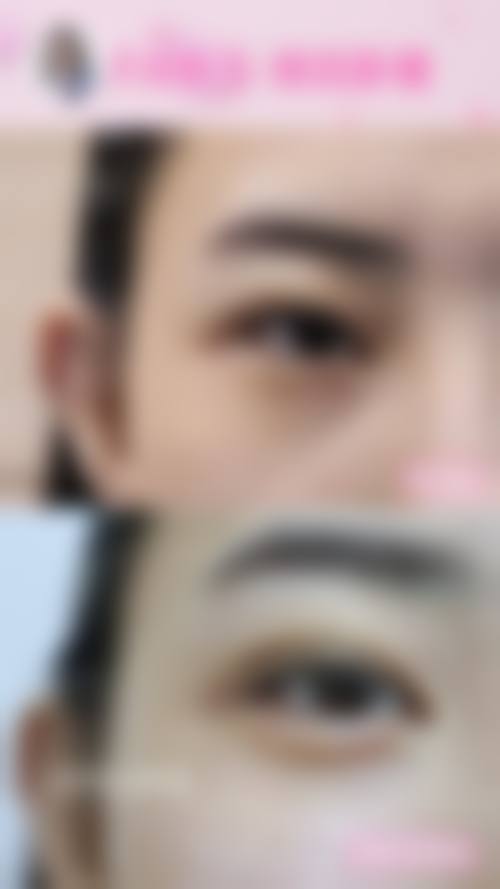 总结:选择正规医美,从雅朴丽德开始