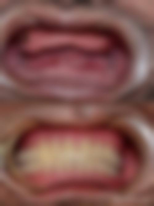 结尾