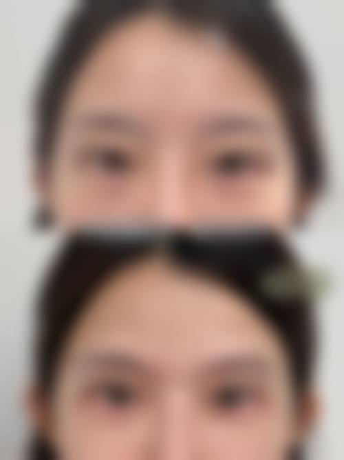 FAQ 任丽医生