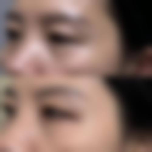 擅长项目详解