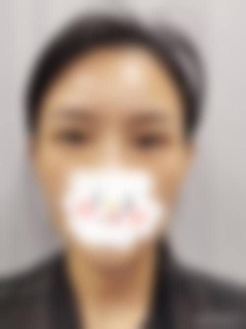 患者真实评价