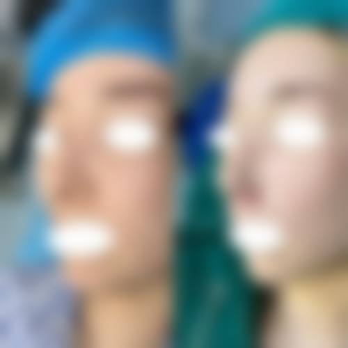 优惠活动详情：专属补贴，即刻锁定美丽