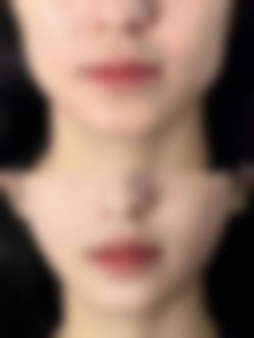 医院资质与实力：正规医美机构的核心保护