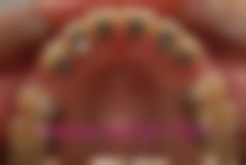 优惠活动详情:原价与优惠价透明对比