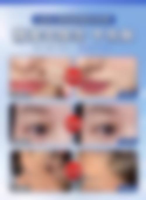 优惠活动详情
