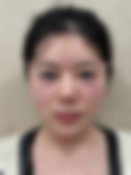 优惠活动详情:如何以更优价格开启蜕变