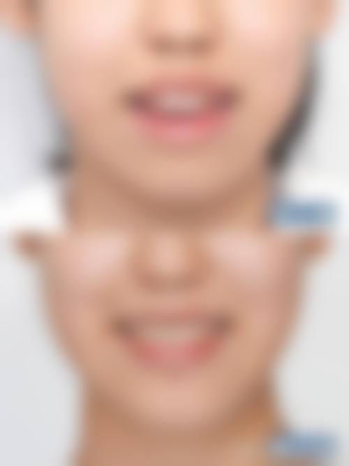擅长项目详解:赵立花医生