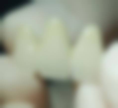 擅长项目详解