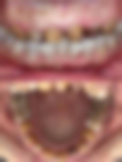 FAQ常见问题解答
