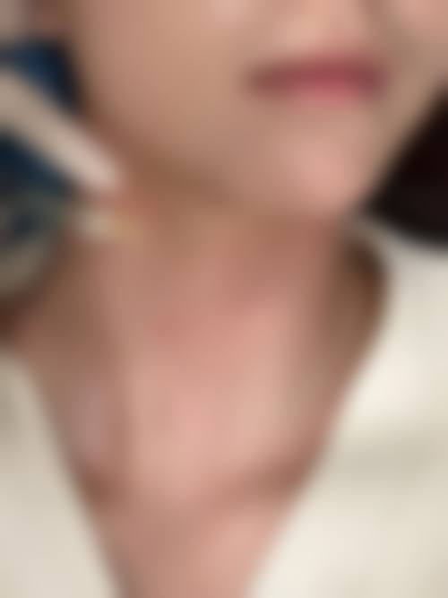 患者真实评价