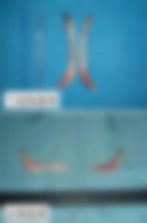 服务与保护:以患者为中 心,全程贴心护理