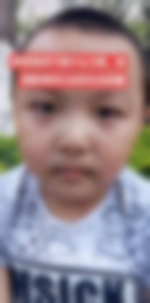 诊疗特色总结 武汉儿童医院眼科