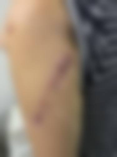 核心医疗项目:定制服务,精细赋能