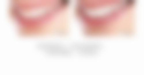 结语:选择永州德皓口腔,开启自信笑容