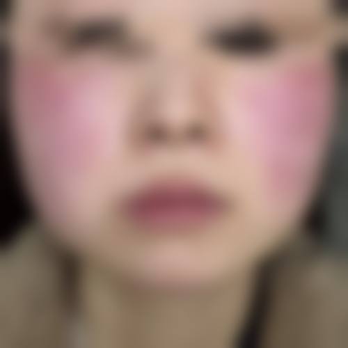 预约优惠活动 董东亮 重庆佳美医疗美容诊所
