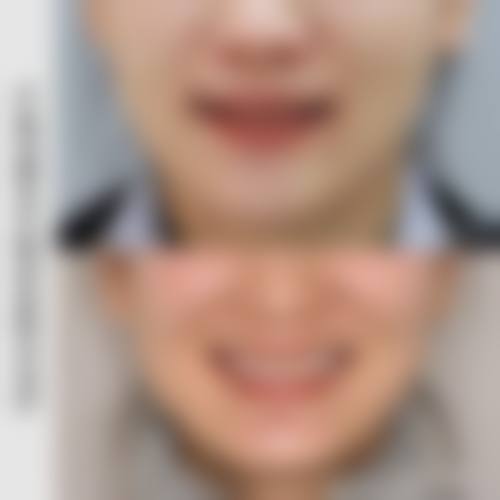 常见问题解答