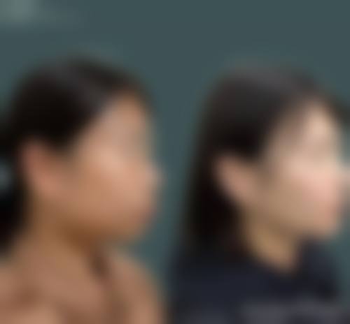 诊疗设备与无菌保护