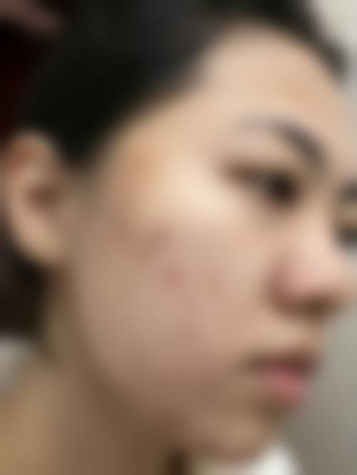 预约优惠活动
