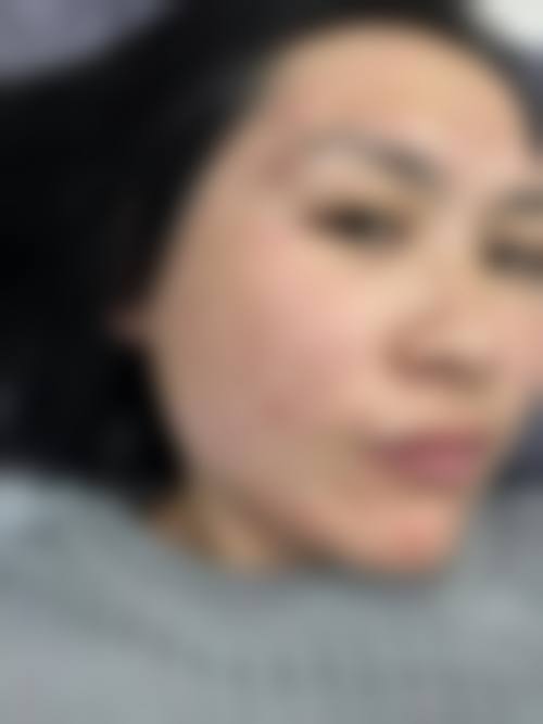 特色项目与技术优势:精细解决面部皮肤问题