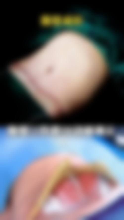 优惠活动详情