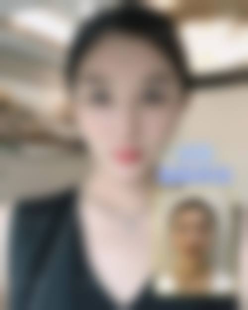 临床实例分享