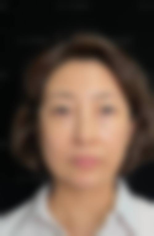 临床实例分享