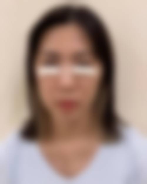 结尾：立即预约，开启安心变得更美之旅