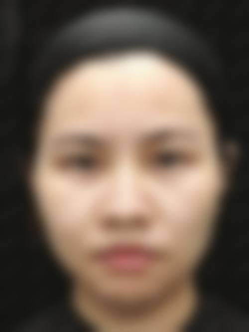 优惠活动详情与预约方式