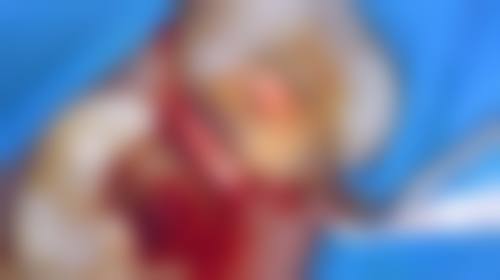 特色科室与项目：精细解决各类牙齿难题